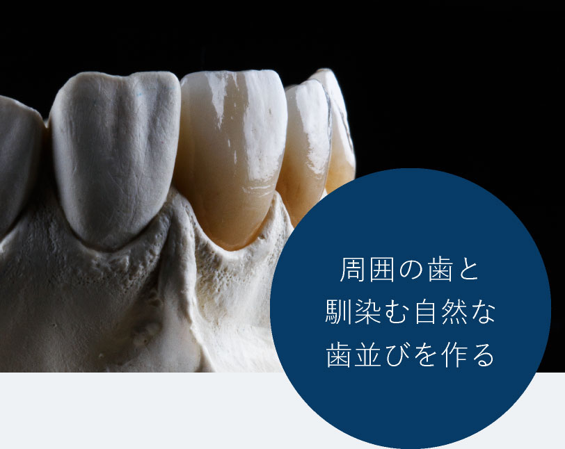 周囲の歯と馴染む自然な歯並びを作る