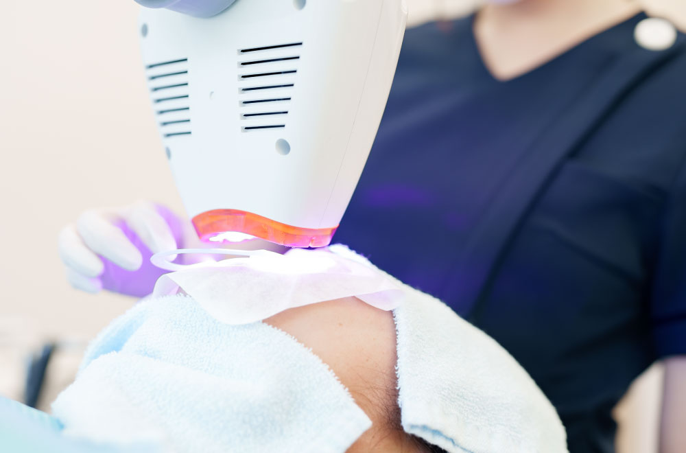 セラミックシェル