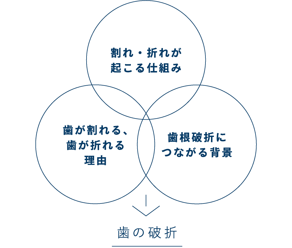 割れ・折れが起こる仕組み＋歯が割れる・折れる理由＋歯根破折に繋がる背景　→歯の破折