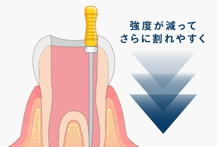 強度が減ってさらに割れやすく